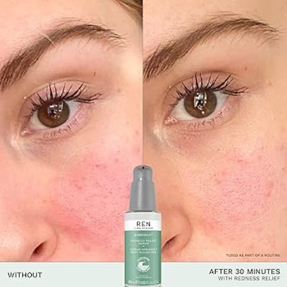 💝NEW REN EverCalm Redness Relief Serum💝 - Picture 6 of 7